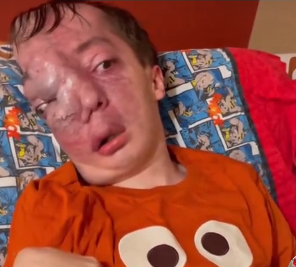 HELP SCOTTY RAISE FUNDS FOR HIS SUGERY logo